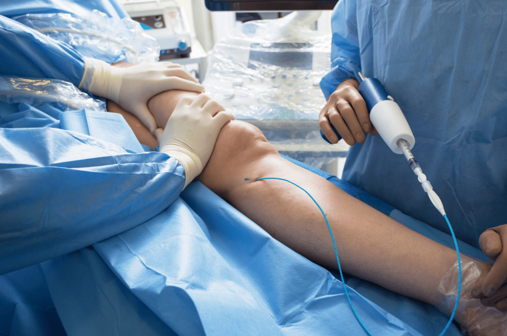 Medical breakthroughs in vein disease care at Renew Vein & Vascular.
