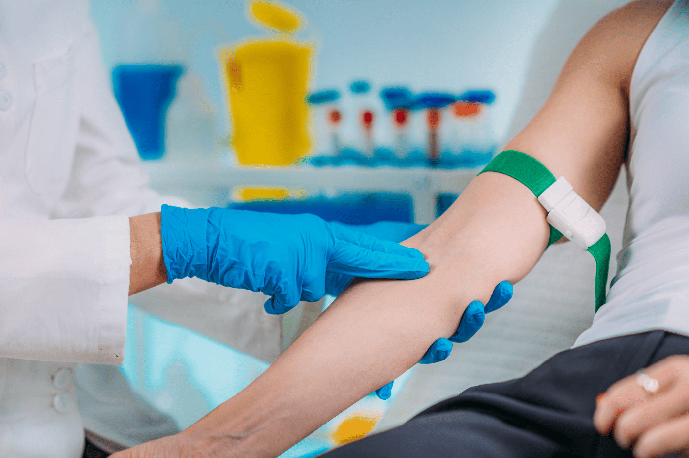 Post-phlebectomy recovery and results at Renew Vein & Vascular.